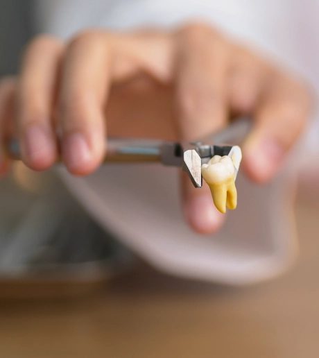 A close up of a hand holding a natural tooth representing a tooth extraction procedure