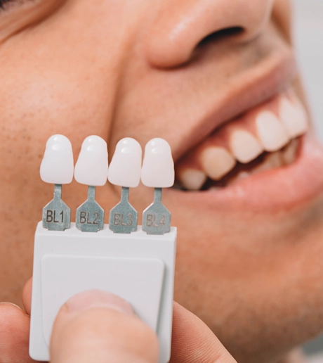 Dentist matching veneer shades for a patient considering veneers in Henderson
